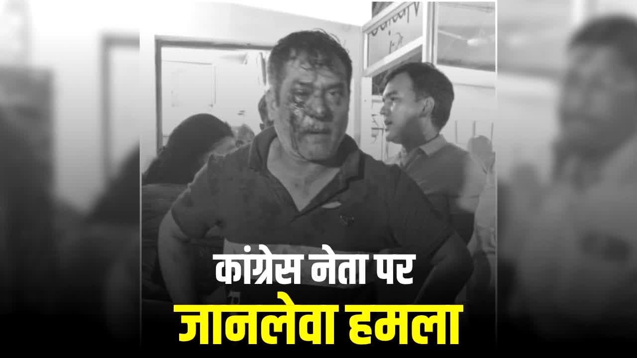 Chhattisgarh Congress Leader Attack: छत्तीसगढ़ में कांग्रेस नेता पर जानलेवा हमला, इस BJP नेता पर हमला करवाने का आरोप, 15 से ज्यादा बदमाश घर में घुसे फिर….पत्नी को भी नहीं छोड़ा
